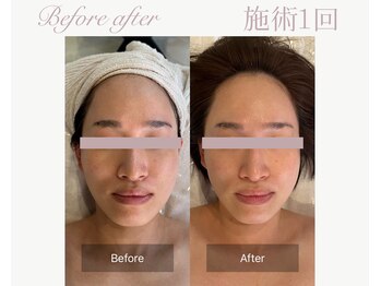 パルタージュ(Partage)/