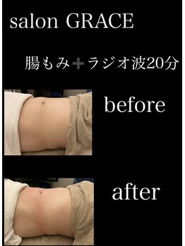 サロン グレイス(salon GRACE)/