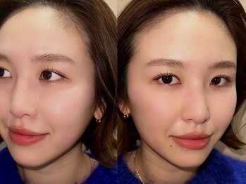 ウオン(uon)の写真/【まつ毛で魅せる華やかさ◎】忙しい日常でも、目元はいつだって輝いていたい。あなたの目元に、自信を。