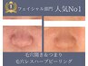 【大好評毛穴ケア】毛穴レス/ハーブピーリング・ヘッド+デコルテマッサージ付