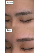 ビュー テンジン 天神 大名(VIEW TENJIN)/アイブロウ（眉毛）ワックス脱毛