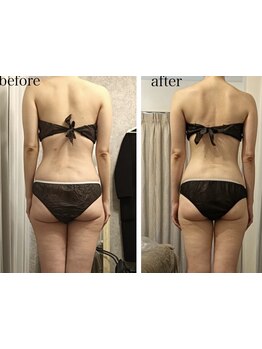 サイズダウンを目指したい