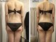 リープ(Lieb)の写真/【結果重視】施術人数7万人超えのプロによる施術で年齢と共に凝り固まった脂肪を温熱マシンで撃退!満足度◎