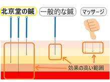 北京堂鍼灸首里 いじゅ治療院/一般的な鍼やマッサージとの違い