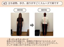 ピースフルポイント(Peaceful Point)/姿勢改善整体 before/After