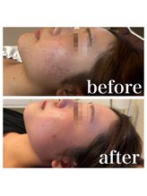 オリンピア 横浜(OLYMPIA)/