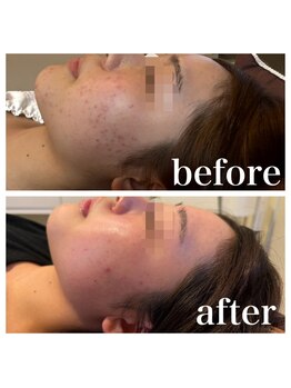 オリンピア 横浜(OLYMPIA)/