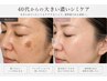 【初めての方】 40代からのシミ診断＆シミケア体験10名限定！￥22,000→9,900