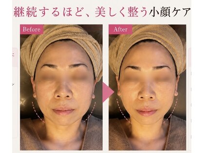 ユフラの写真