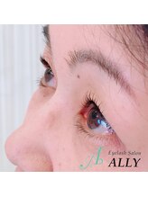 アリー(ALLY)/