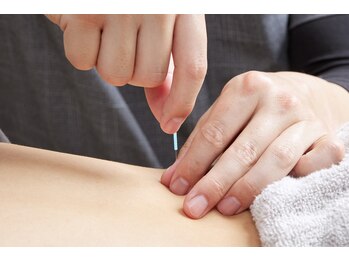 前橋miraie鍼灸整骨院(前橋ミライエ鍼灸整骨院)/施術風景[整体/小顔/前橋/群馬]