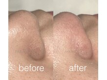 ジェジル バイ ジュリ(JAEJIL by Juri)/フェイシャルワックス