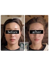 キュープ 小倉店(Qpu) 人気No.1 オイル