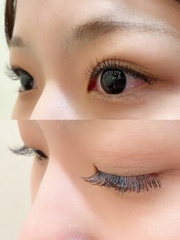 ビヨウシツチャーリー/フラットラッシュ120本