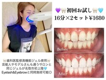ニュイ(＿N＿nyui)の雰囲気（【Whitening】白い歯で明るい印象に◇◇まつ毛や眉毛と同時OK◎）