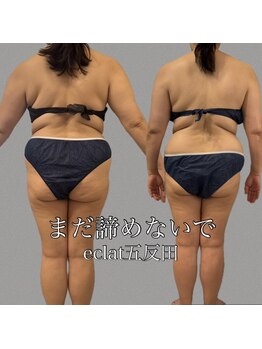 短期集中コースのあるサロン