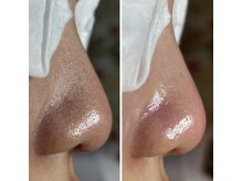 フラリス(fraris)/