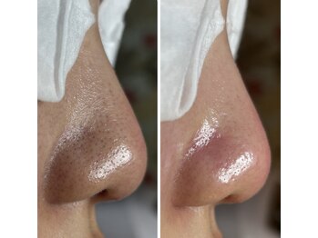 フラリス(fraris)/