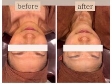 エステ ココ 荻窪店(Esthe CoCo)/美肌/肌管理/毛穴