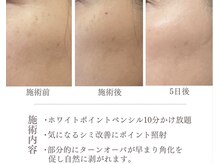 リノア 柏(Lino'a)/ポイントシミケア角化を促します