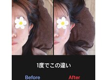 美容矯正サロン レレポノ(LELEPONO)/