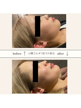 ヘッドミント 福井店の写真/リフトアップ小顔コルギ50分￥4000☆本場の本格コルギで小顔美人へ◎