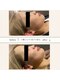 ヘッドミント 福井店の写真/リフトアップ小顔コルギ50分￥4000☆本場の本格コルギで小顔美人へ◎
