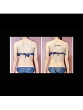 ナコズ エステティック(Nakos esthetic)/肩甲骨で印象変わります♪