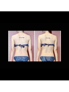 ナコズ エステティック(Nakos esthetic)/肩甲骨で印象変わります♪