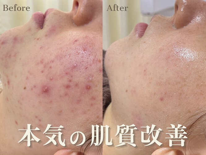 ルヴィ 藤岡店(REVI)｜ホットペッパービューティー 