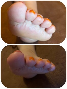 ミロク(MIROKU.)/足指調整