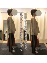 岡山整体 リソル(Resol)/姿勢改善ビフォーアフター