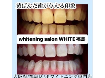 ホワイトニングサロン ホワイト(WHITE)/セルフホワイトニング/大阪/福島