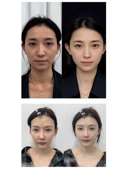 シホン 博多(SHIHON)/