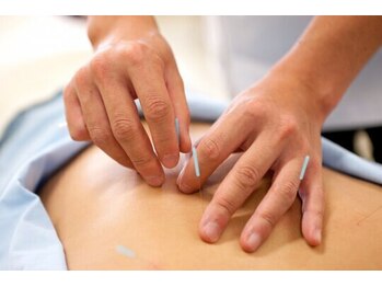 もりわき骨盤鍼灸整骨院 堺筋本町の写真/自律神経を整え不眠,頭痛,めまい等の改善に。【自律神経の乱れ・ストレス改善！】鍼灸施術+骨盤矯正¥3980