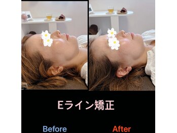 美容矯正サロン レレポノ(LELEPONO)/