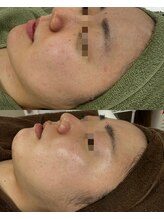 レイ(Lei)/肌質改善ならお任せを