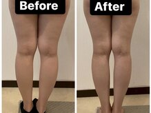 自律神経/痩身/筋膜リリース/リンパマッサージ《WINBACK ウィンバック》Yスタジオ平野の雰囲気（冷えた脚を深部から温め脂肪分解＆プロの本格手技でセル脂肪分解）