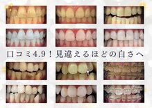 ホワイトニングショップ 府中店