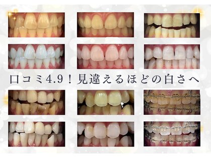 ホワイトニングショップ 府中店の写真