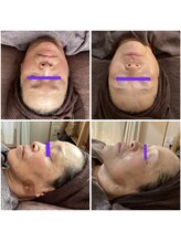 ビビッシュアール(bibiche R)/ハイドロスプラッシュ　