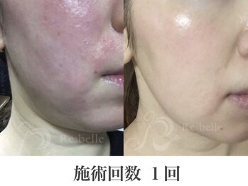 パルファンカルム 駅西本町店/つるつるピカピカ美肌へ!