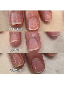 ニマ(nima)の写真/【一回で即実感◎縦長美爪と潤う指先へ】自爪育成スタートコース￥5500円～ご用意しています◎