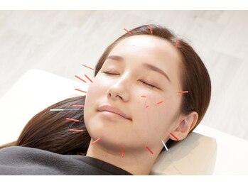 前橋miraie鍼灸整骨院(前橋ミライエ鍼灸整骨院)/施術風景[整体/小顔/前橋/群馬]