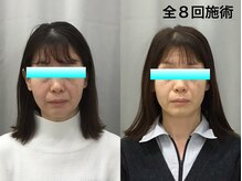 金沢西えみふる整骨院 整体院/小顔/骨盤矯正/肌ケア/整体