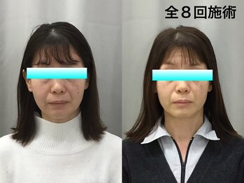 金沢西えみふる整骨院 整体院/小顔/骨盤矯正/肌ケア/整体