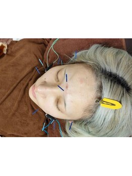 お肌をきれいにしたい