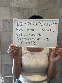 グラシア(gracia)/シミ毛穴ケア専門店gracia