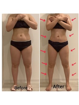 スペチアーレ 夙川/ハイパーナイフで代謝UP