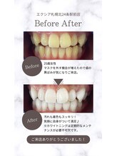 エクシアホワイト 平岸駅前店/